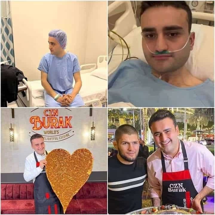 Chef Confirms CZN Burak Doesn't Have A Brain Tumor