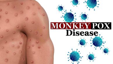 Monkeypox Disease Declared As World Health Emergency
